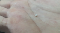 Atopan unha perla nunha ostra nun restaurante de Pontevedra