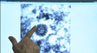 O Hospital do Mar de Barcelona consegue amosar o aspecto do coronavirus