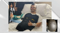 Ángel, policía galego ferido en Barcelona, recibe hoxe a alta