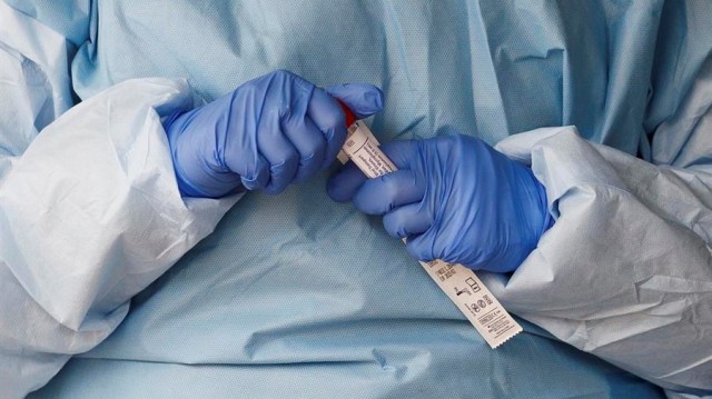 Sanidade rebaixa a 32 as mortes semanais con Covid-19 e rexistra 156 novos contaxios